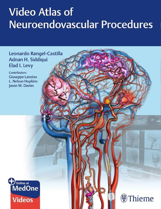 Video Atlas of Neuroendovascular Proced (Jason Davies, L. Nelson Hopkins, Giuseppe Lanzino, Elad I. Levy, Adnan H. Siddiqui, 2020)