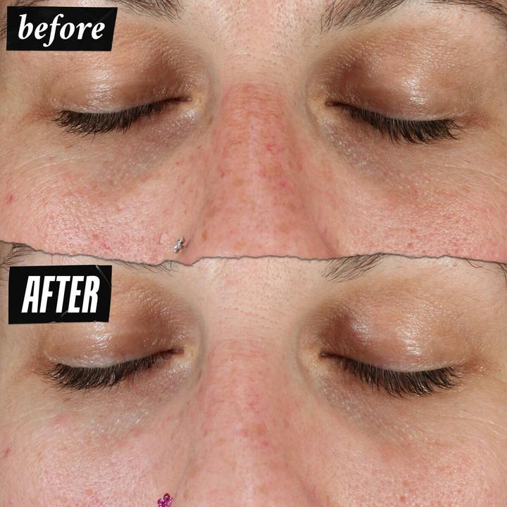 Actual product image Kiehl's Clearly Corrective Dark Spot Solution (100 ml)