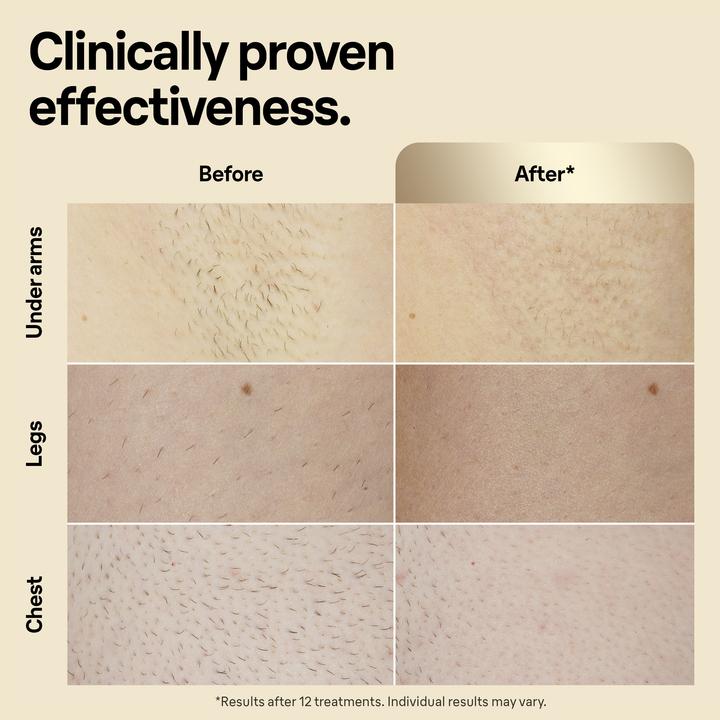 Image du produit Braun Silk·expert Pro 5