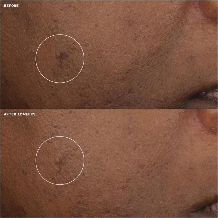 Produktbild Clinique Even Better Clin Brightness Moisturizer (15 ml)