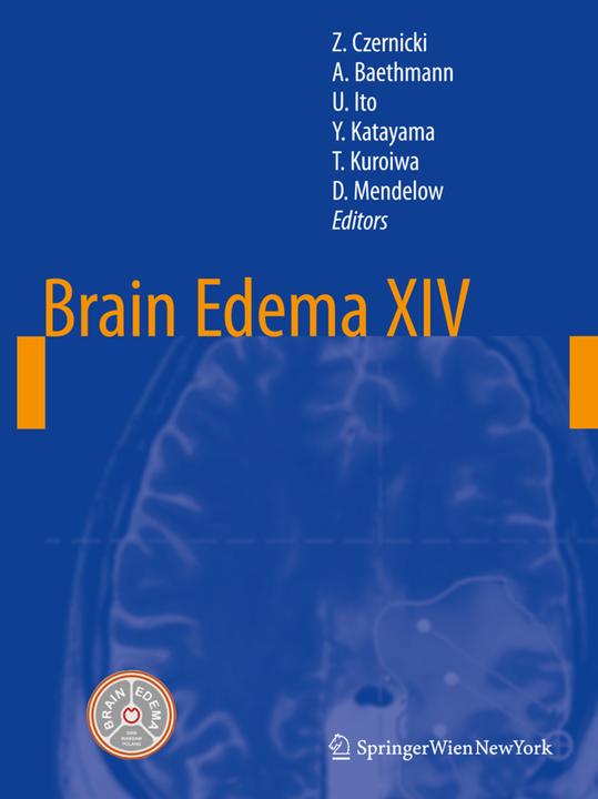 Springer Brain Edema XIV - buy at Galaxus
