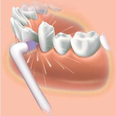 Actual product image Panasonic Ew0940 (Oral irrigator attachments)