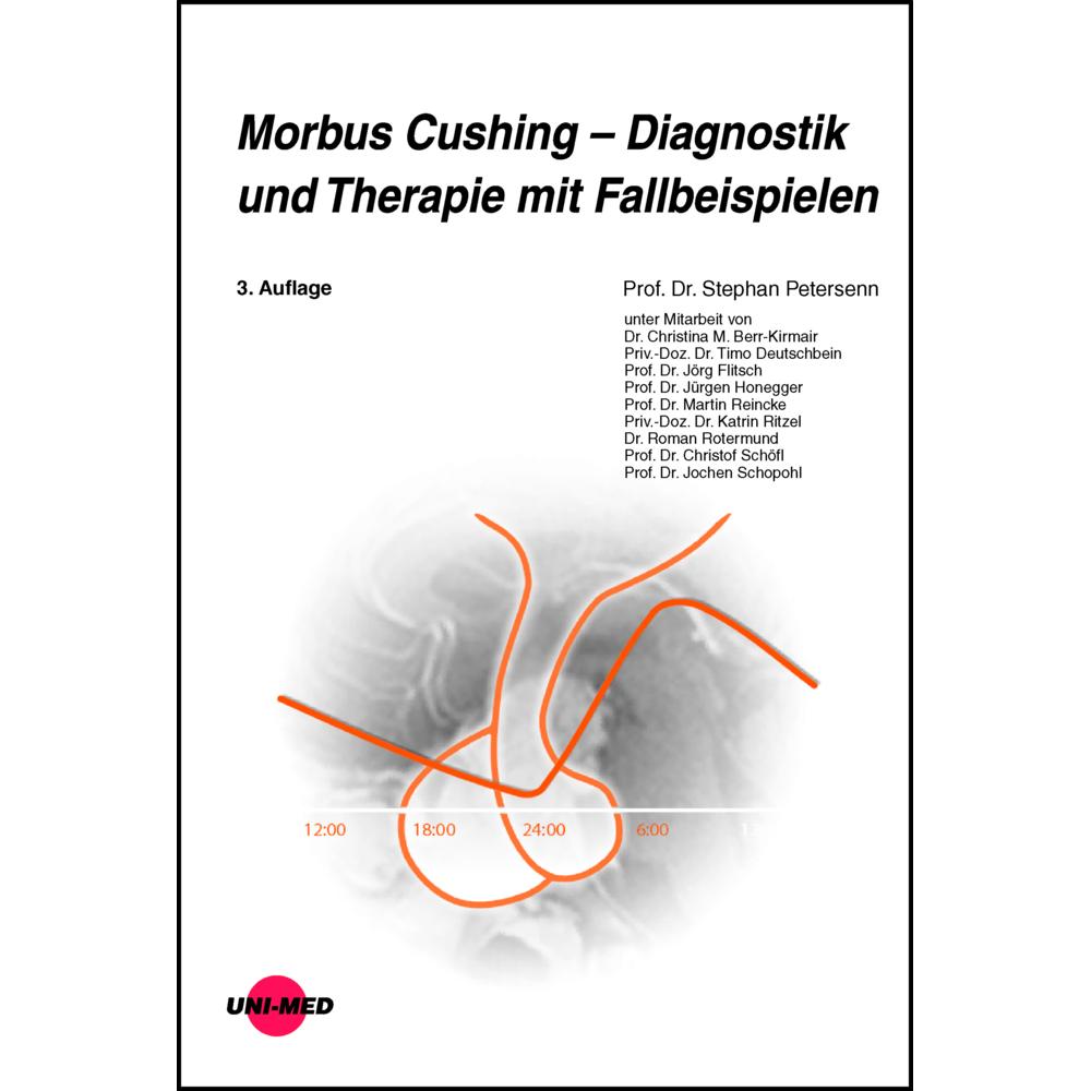 Petersenn:Morbus Cushing - Diagnostik u, Ratgeber von Stephan Petersenn