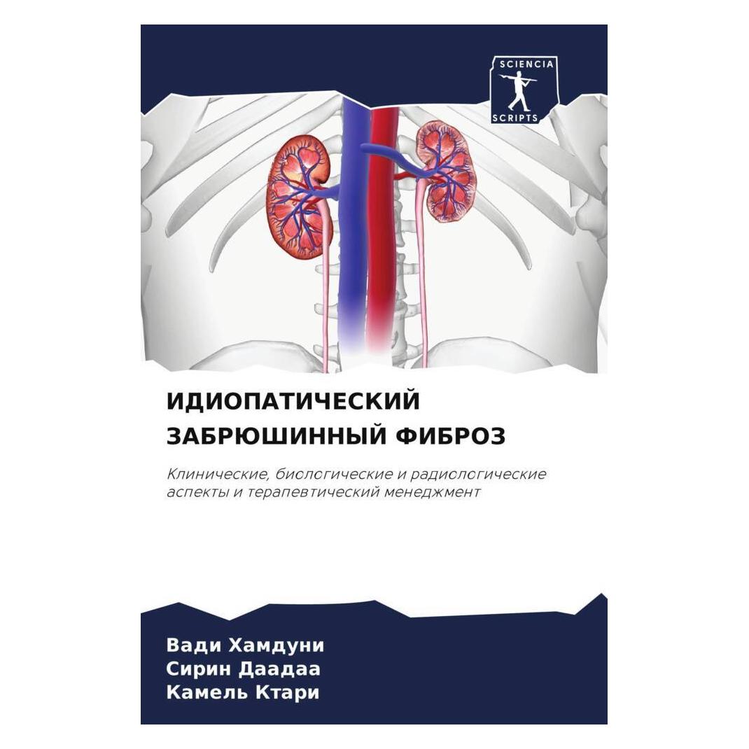 Various Publishers Idiopaticheskij Zabrjushinnyj Fibroz (51486423)