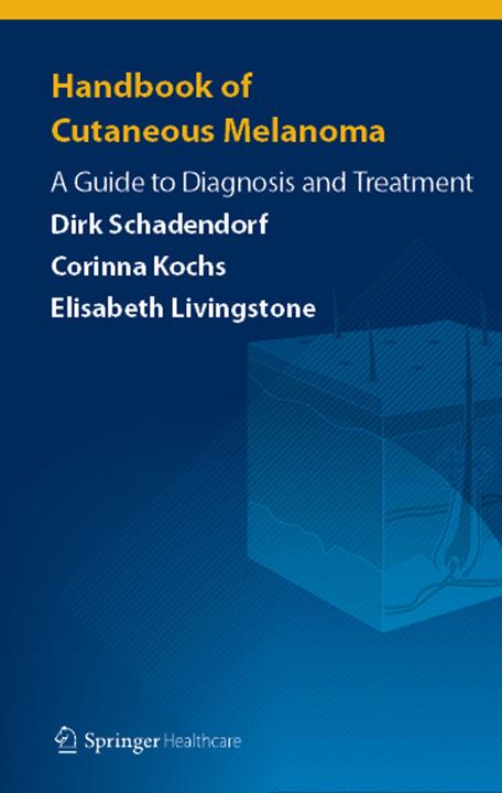 Produktbild Handbook of Cutaneous Melanoma (Englisch, Corinna Kochs, Dirk Schadendorf, Elisabeth Livingstone, 2014)