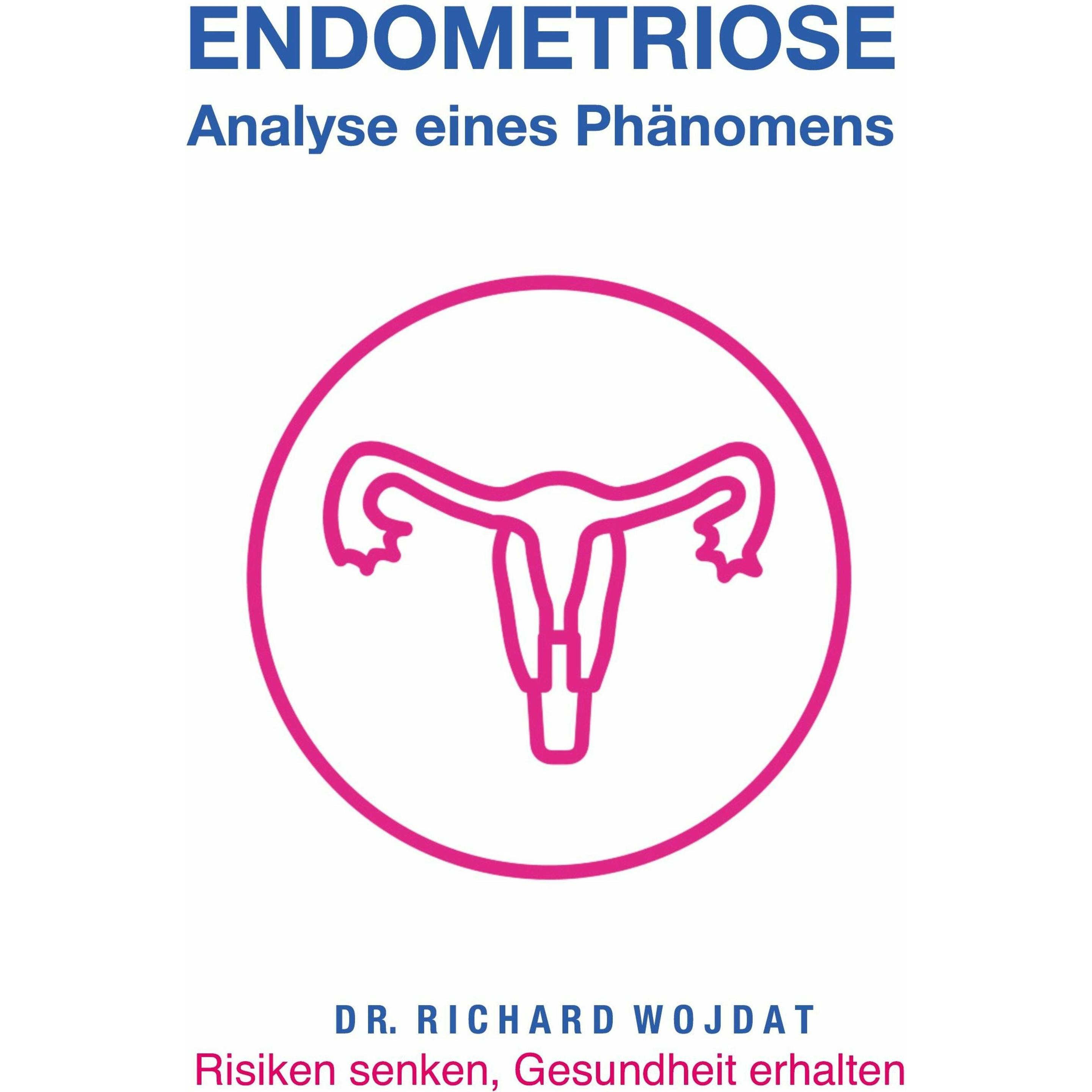 Endometriose, Eine Analyse eines Phänomens, Fachbücher von Richard Wojdat