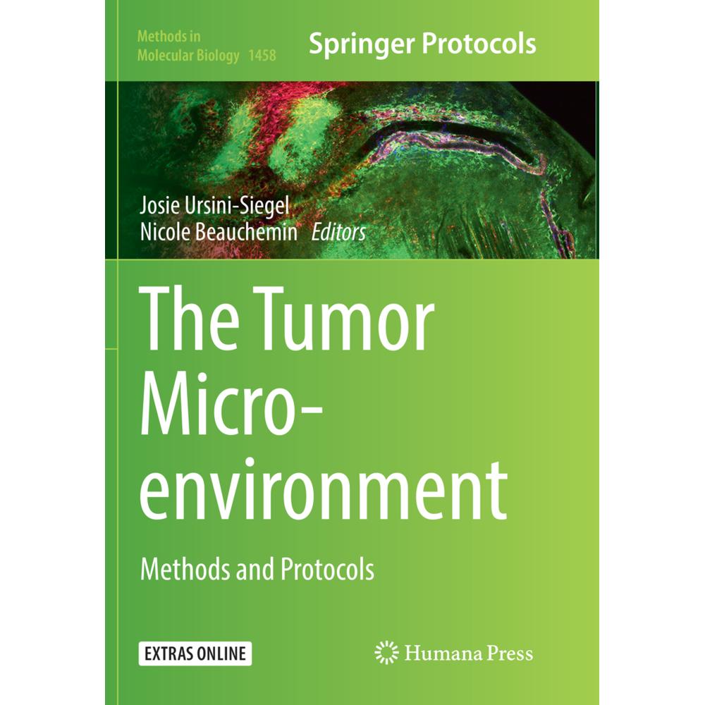 The Tumor Microenvironment, Fachbücher von Nicole Beauchemin, Josie Ursini-Siegel