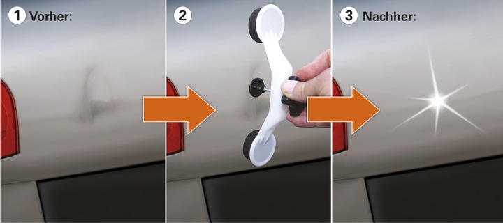 Produktbild Quixx Dellen Reparatur-Set