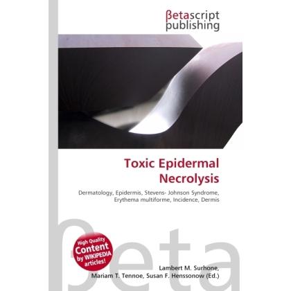 Toxic Epidermal Necrolysis, Fachbücher von Lambert M. Surhone, Miriam T. Timpledon, Susan F. Marseken