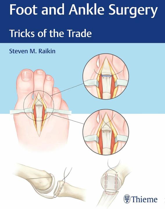Produktbild Foot and Ankle Surgery (Englisch, Steven M. Raikin, Steven Raikin, 2018)