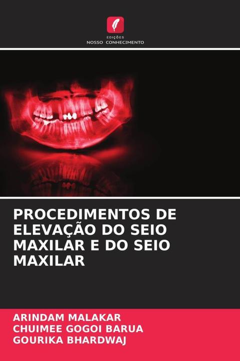 Produktbild Procedimentos De Elevação Do Seio Maxilar E Do Seio Maxilar (Deutsch, GOURIKA BHARDWAJ, Arindam Malakar, Chuimee Gogoi Barua, 2024)