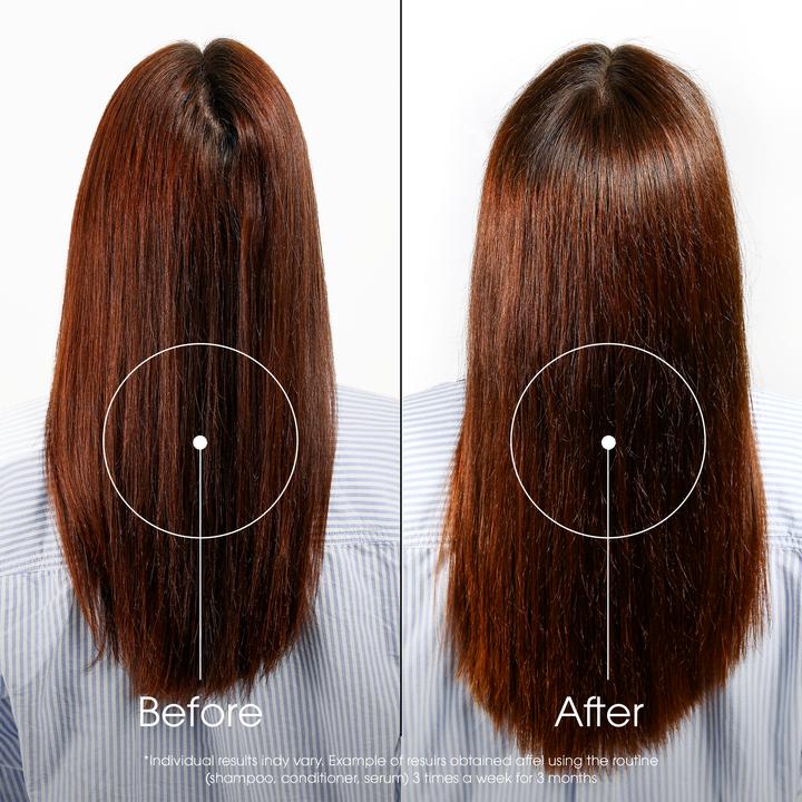 Image du produit Klorane Quinine anti-chute de cheveux (200 ml)