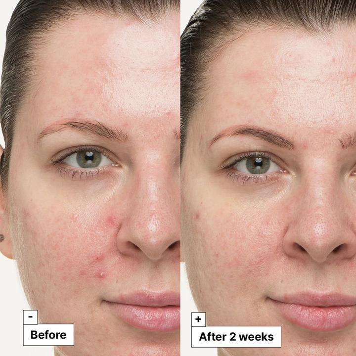 Actual product image Dr. Jart+ Dr.Jart+ Cicapair So Soothing Treatment (30 ml)