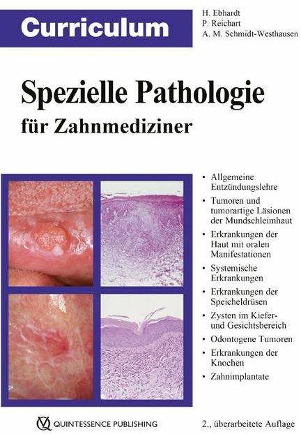 Curriculum Spezielle Pathologie für Zahnmediziner (Deutsch, Peter A. Reichart, Andrea Maria Schmidt-Westhausen, Harald Ebhardt, 2018)