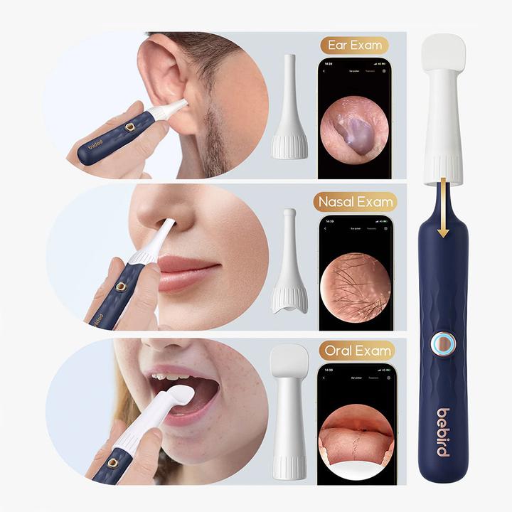 Immagine prodotto Bebird EarSight Plus