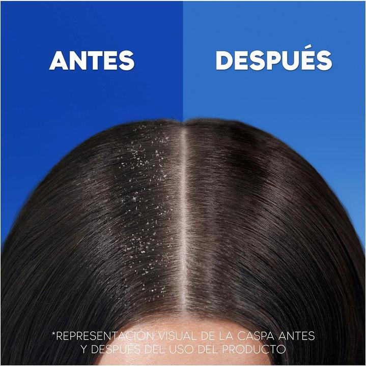 Produktbild Head & Shoulders H&S Classic Shampoo 900ml (1000 ml, Flüssiges Shampoo)