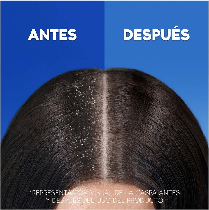 Actual product image Head & Shoulders H&S Classic Shampoo 900ml (1000 ml, Liquid shampoo)