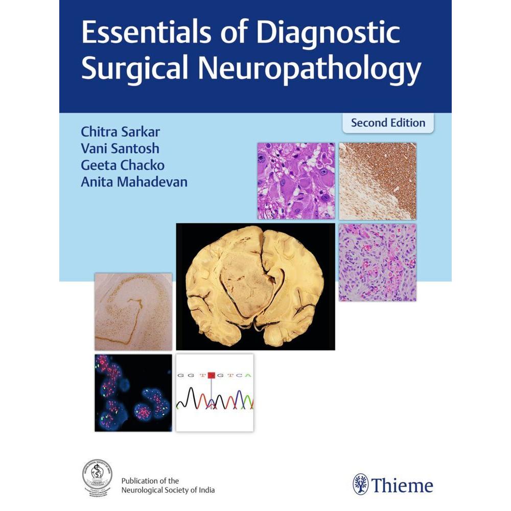 Essentials of Diagnostic Surgical Neuropathology, Fachbücher von Anita Mahadevan, Geeta Chacko, Vani Santosh, Chitra Sar...