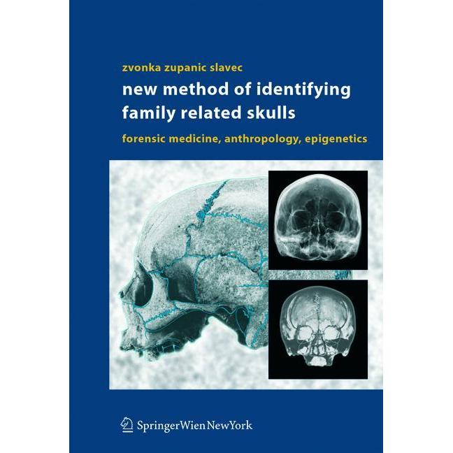 New Method of Identifying Family Related Skulls, Fachbücher von Zvonka Zupanic Slavec