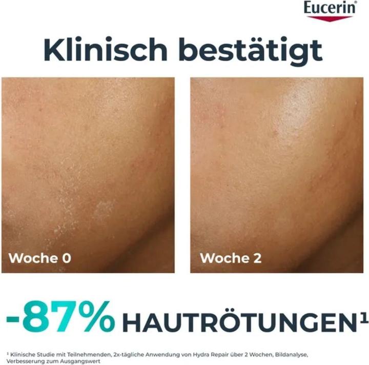 Produktbild Eucerin Therapiebegleitende Feuchtigkeitspflege (40 ml, Tagescreme)