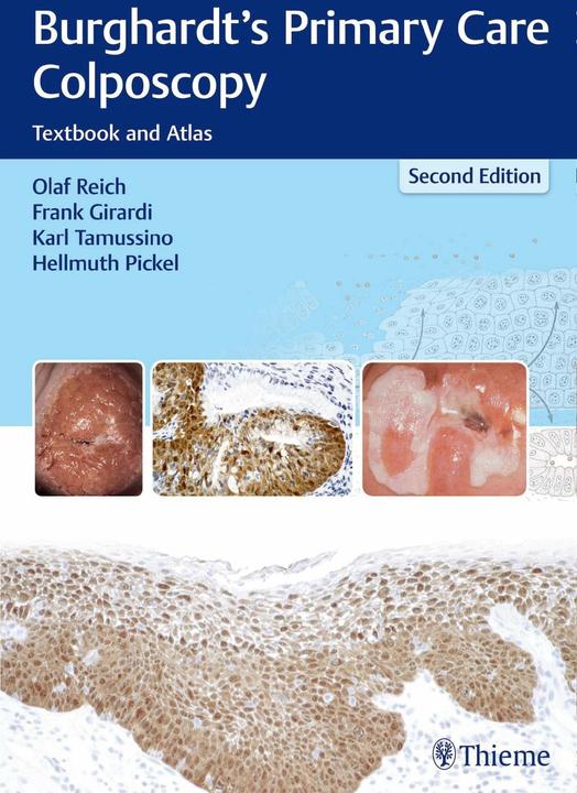Produktbild Burghardt's Primary Care Colposcopy (Englisch, Frank Girardi, Hellmuth Pickel, Karl Tamussino, Olaf Reich, 2016)