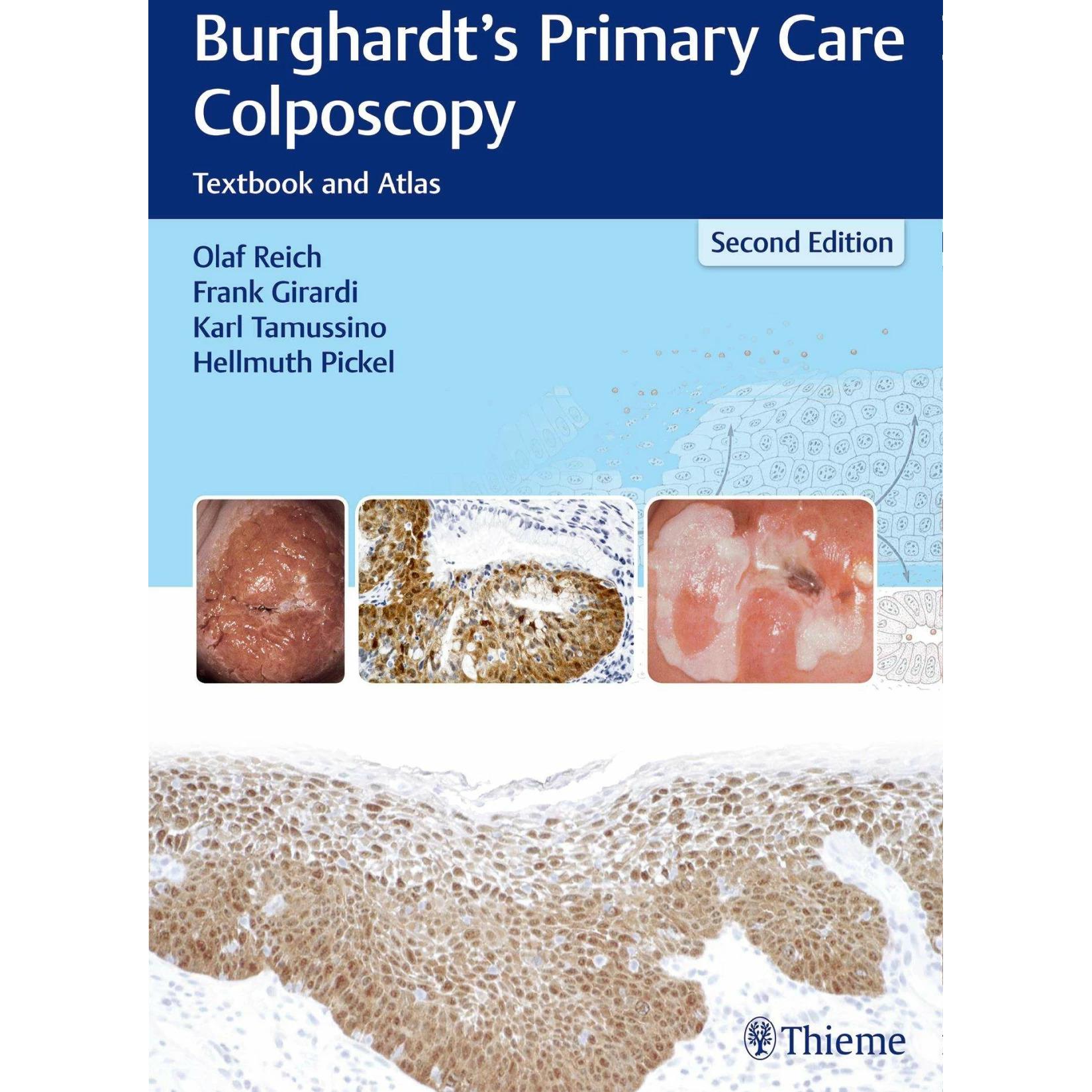Burghardt's Primary Care Colposcopy, Fachbücher von Frank Girardi, Olaf Reich, Hellmuth Pickel, Karl Tamussino