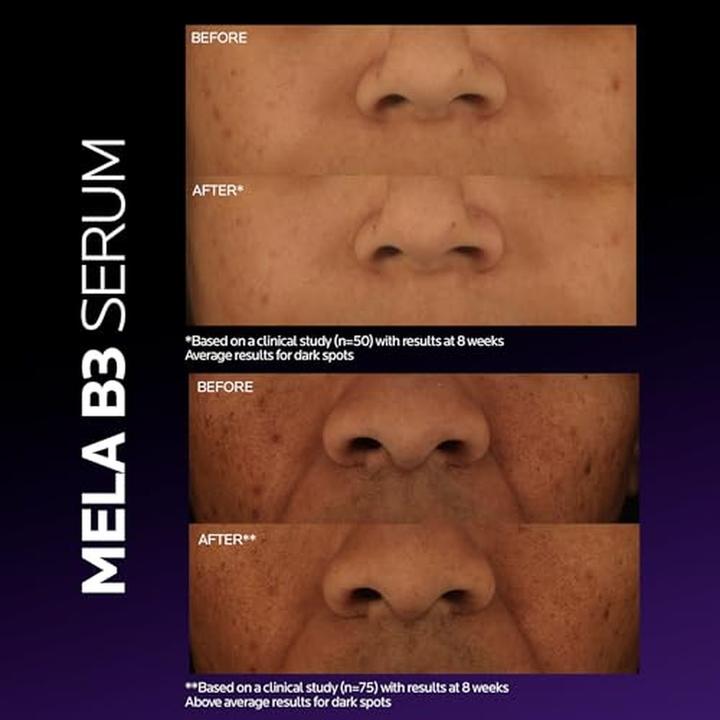 Actual product image La Roche Posay Mela Serum B3 (30 ml)