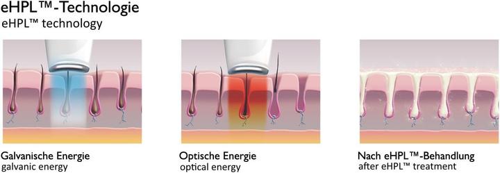 Actual product image Silk'n Silkn Infinity Premium 500000 light pulses IPL eHPL technology 2in1 permanent hair removal