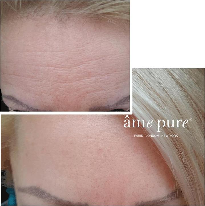 Produktbild Âme pure WrinklEraser™ Basic (30 ml, Gesichtsgel)