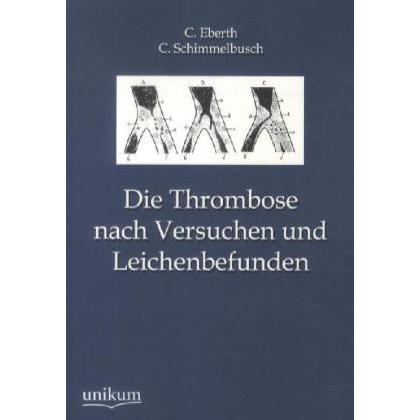 Die Thrombose nach Versuchen und Leichenbefunden, Fachbücher von C. Schimmelbusch, C. Eberth