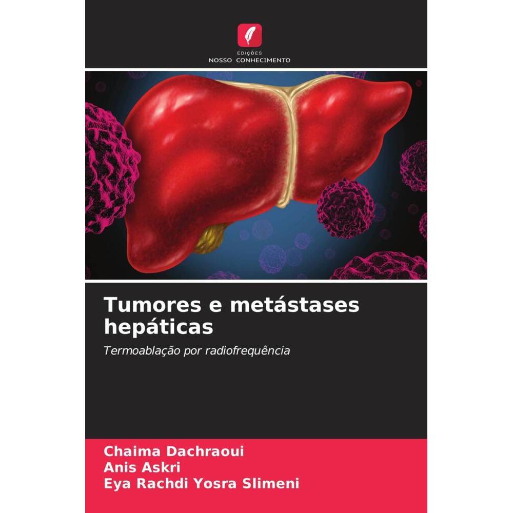 Tumores e metástases hepáticas, Fachbücher von Chaima Dachraoui, Anis Askri, Eya Rachdi Yosra Slimeni