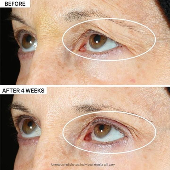 Actual product image StriVectin Tightening (Eye care serum, 30 ml, Day + Night)