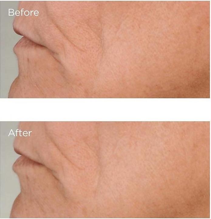 Produktbild Perricone MD High Potency Growth Factor Firm & Lifting Gesichtsserum 59 ml Frauen Frisch (59 ml)