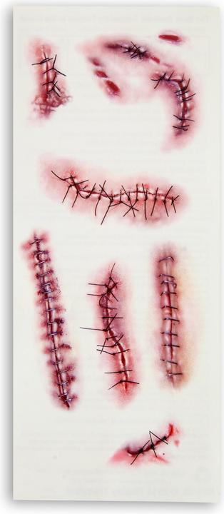 Actual product image Widmann Stitched wound