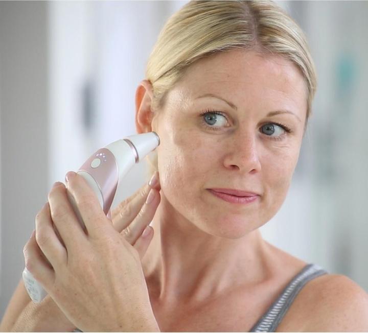 Actual product image Homedics HoMedic Microdermabrasion Device MDA-100RG