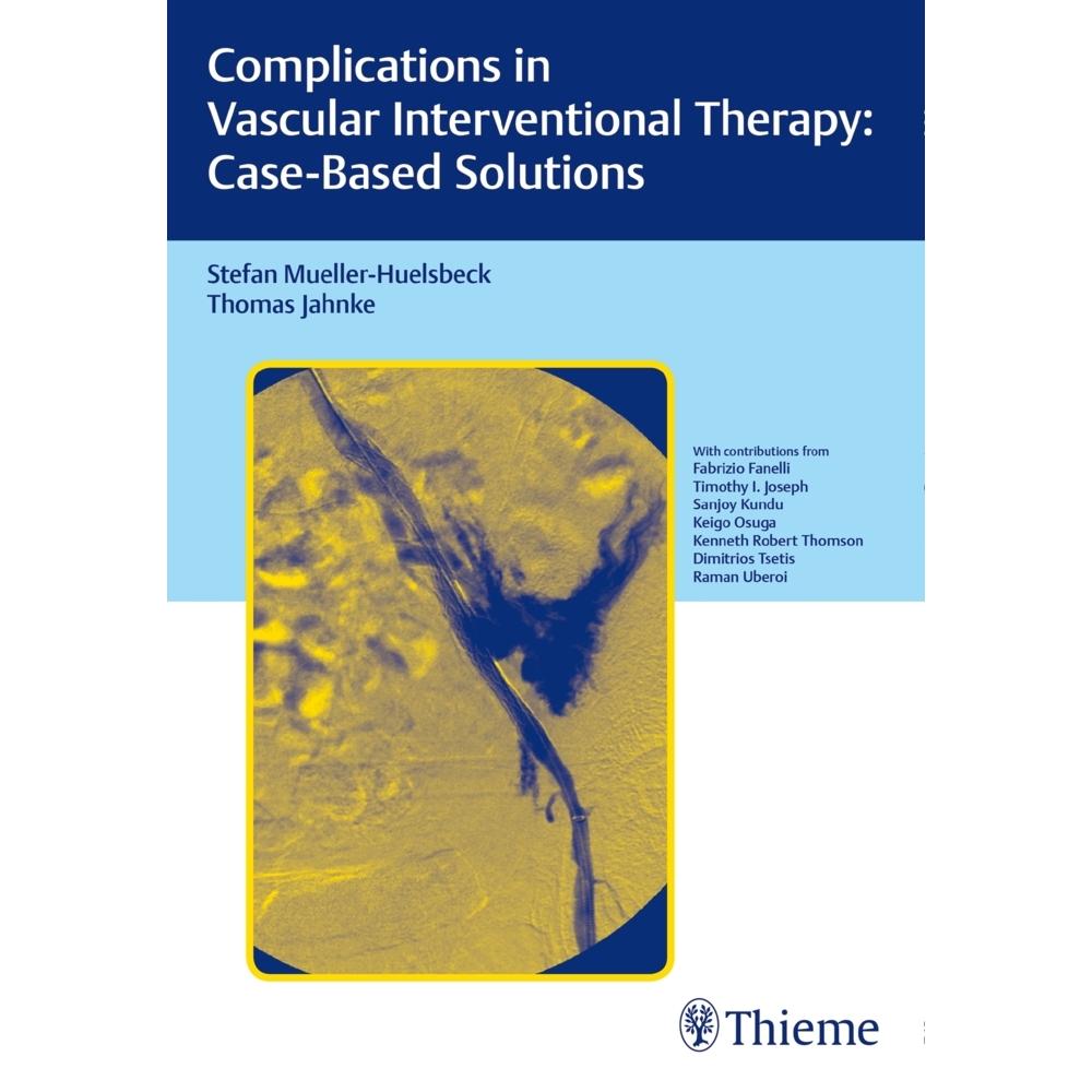 Müller-Hülsbeck.Complications.Vascular, Fachbücher von Thieme