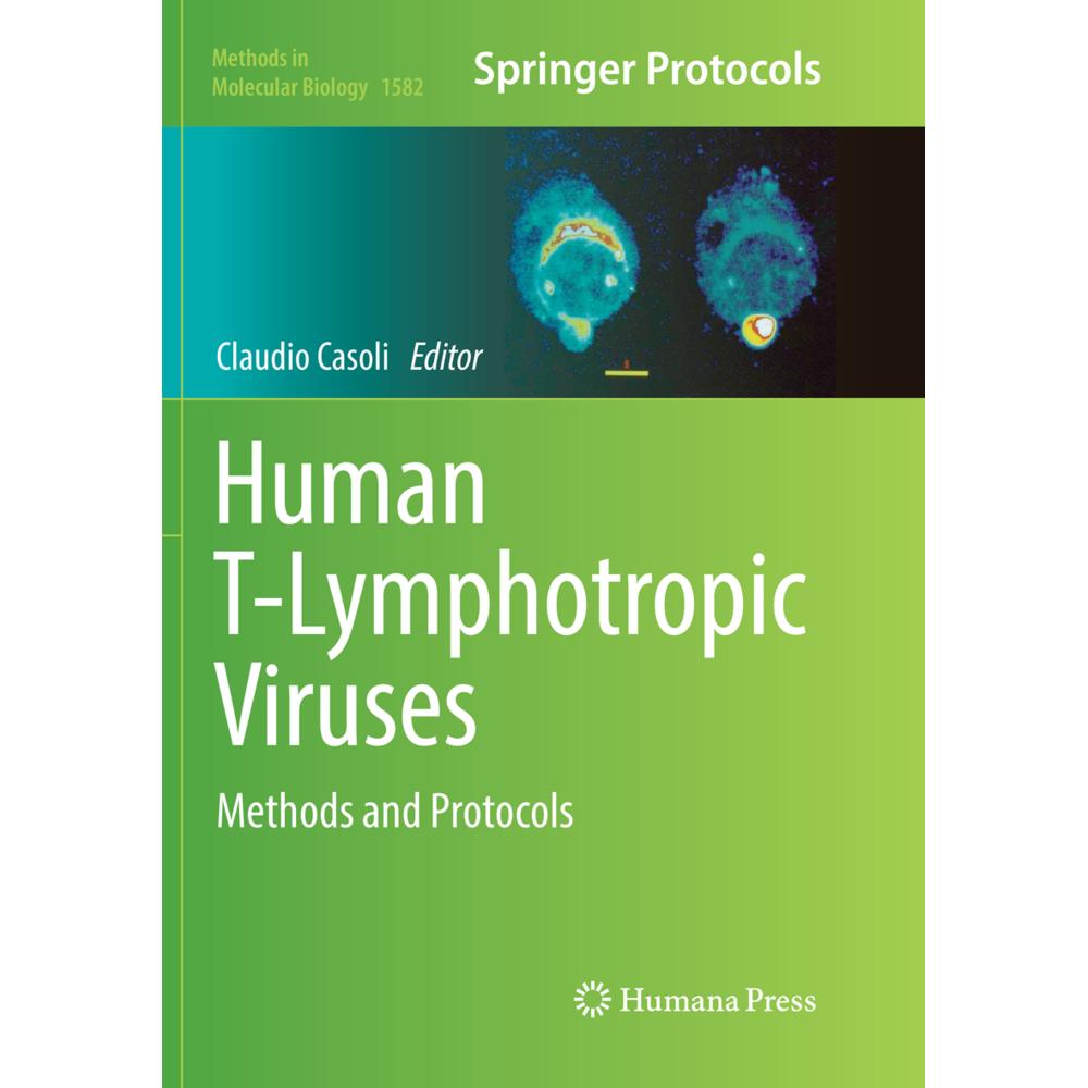 Human T-Lymphotropic Viruses, Fachbücher von Claudio Casoli