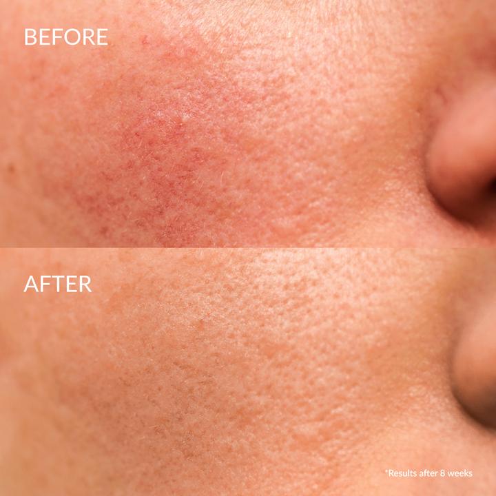 Actual product image Iren Shizen Serum Keep calm (20 ml)