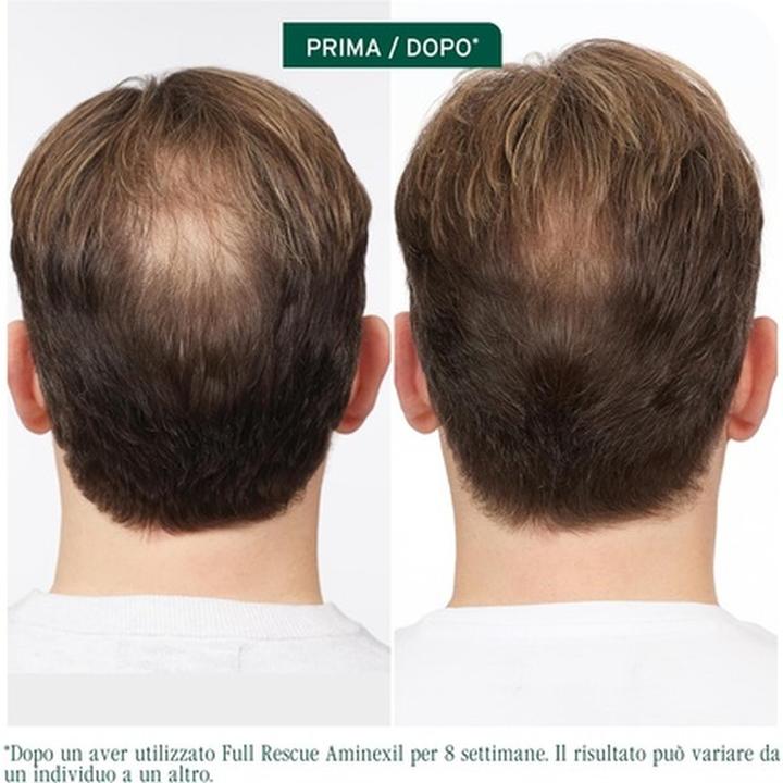 Immagine prodotto Biolage Anti-Hair Loss Treatment in Vials for Fine Hair