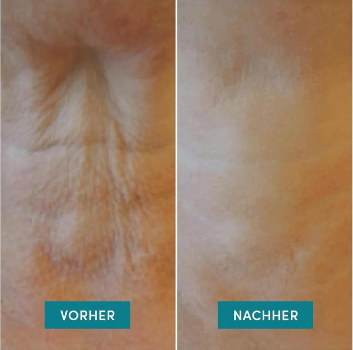 Immagine prodotto Apricot - Wiederverwendbares Nackenkissen Mit Hyaluron It's Neck Or Nothing - 1 Stk.