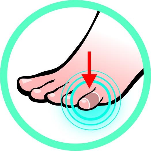 Produktbild Sidas Toe Protector 5x (5 x)