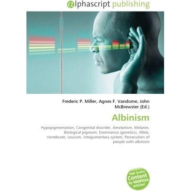 Thumbnail - Albinism, Fachbücher von Agnes F. Vandome, Frederic P. Miller, John McBrewster