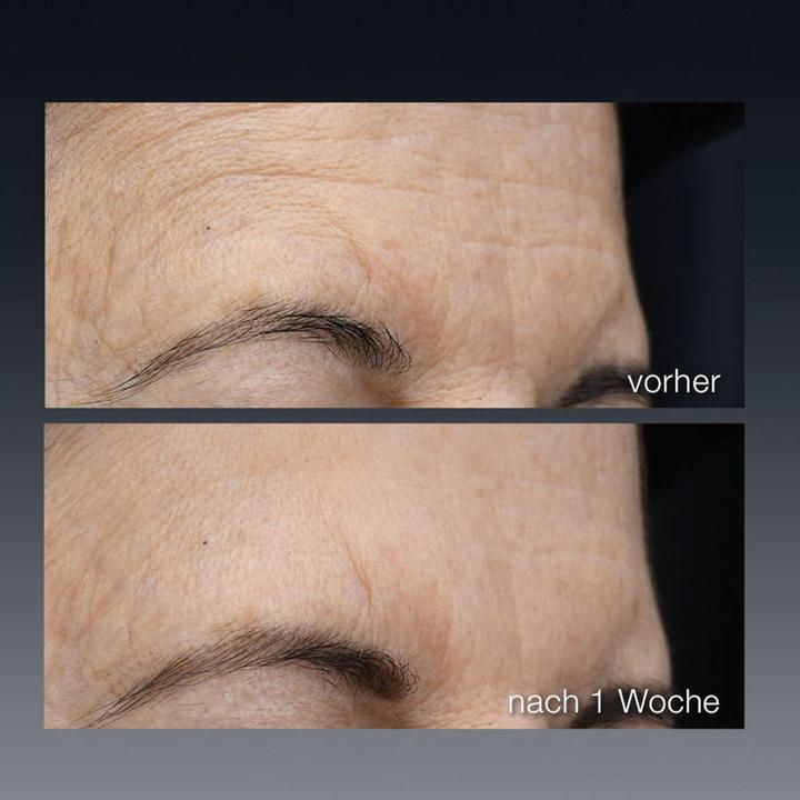 Image du produit Dermalogica Futurecode Booster