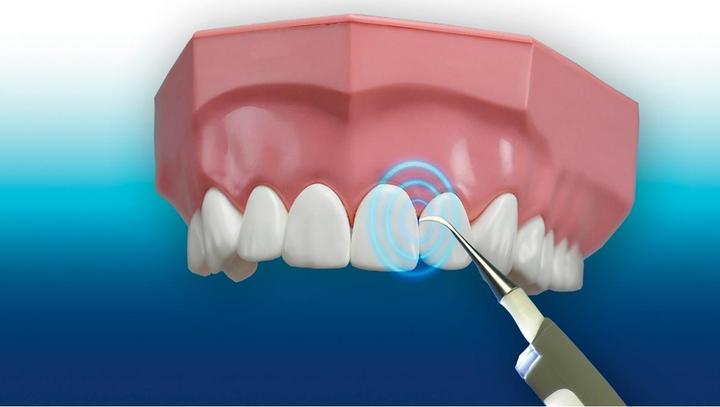 Actual product image MediaShop Tooth cleaning system (Toothbrush steriliser)