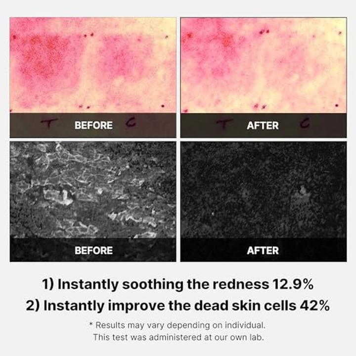 Immagine prodotto Medicube Cica Daily (Salviette detergenti per il viso, 70 ml)