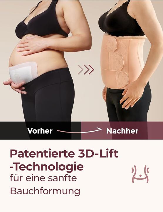 Actual product image Momcozy Postpartum Bauchband mit 3D-Kompression & Rückenstütze (XL)