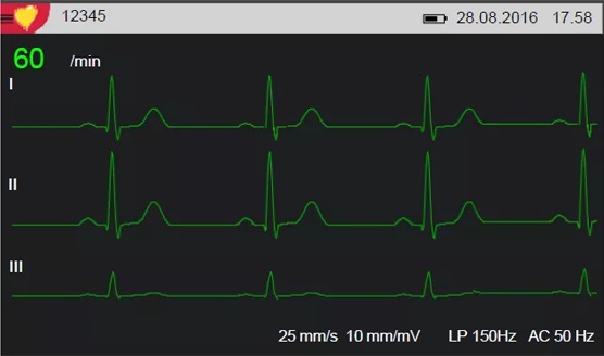 Produktbild Ruhe-EKG Cardiovit AT-1 G2 mit Interpretationsoption