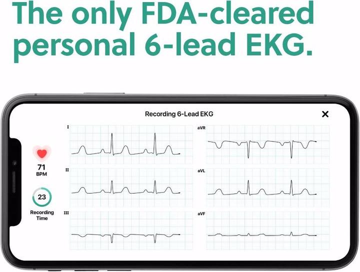 Actual product image AliveCor Kardiamobile 6L