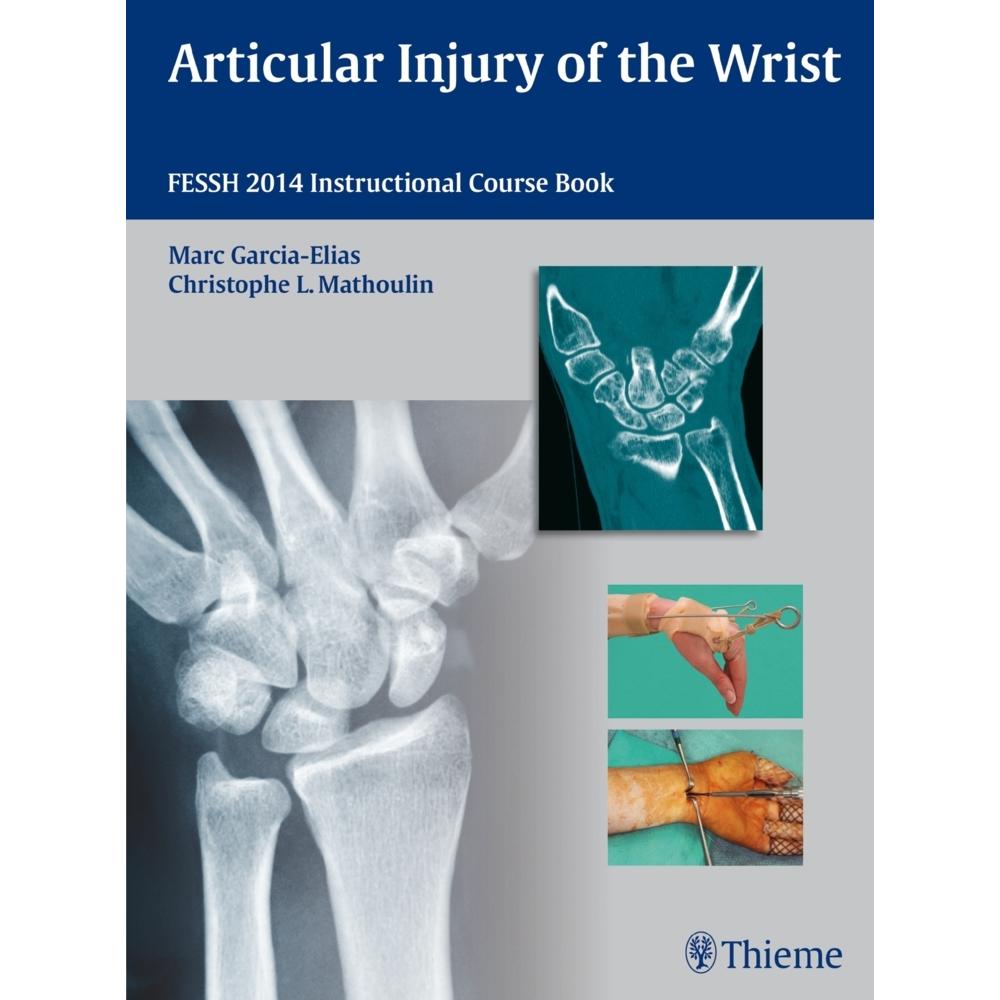 Garcia-Elias:Articular Injury o.Wrist, Fachbücher von Marc Garcia-Elias, Christophe Mathoulin