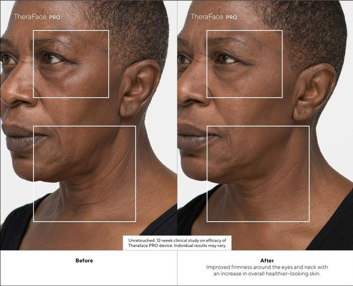 Produktbild Therabody TheraFace PRO, schwarz